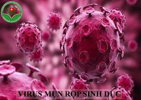 bệnh mụn rộp sinh dục là gì bệnh mụn rộp sinh dục là gì