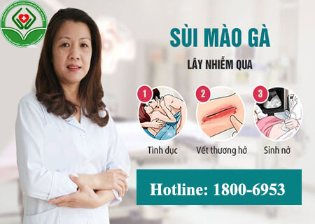 Bệnh sùi mào gà vùng kín nam nữ Bệnh sùi mào gà vùng kín nam nữ