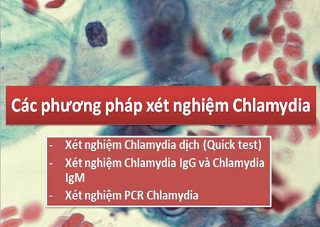 Các phương pháp xét nghiệm chlamydia