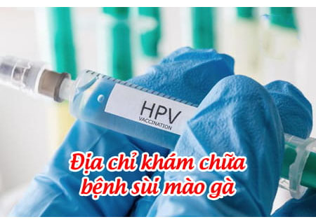 Điều trị HPV gây sùi mào gà tại phòng khám Kinh Đô