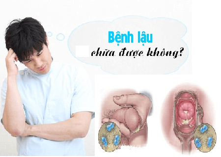 Phương pháp chữa bệnh lậu