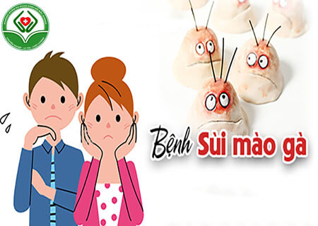 Tìm hiểu bệnh sùi mào gà Tìm hiểu bệnh sùi mào gà