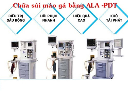 Chữa sùi mào gà bằng phương pháp ALA-PDT mang lại h.iệu q.uả ca0