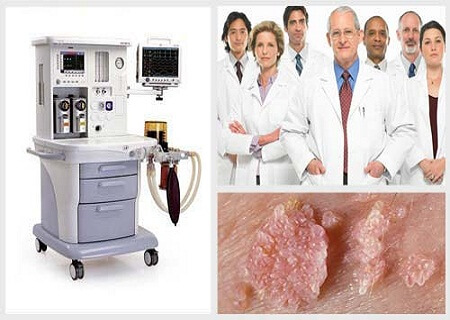 phương pháp điều trị sùi mào gà hậu môn phương pháp điều trị sùi mào gà hậu môn