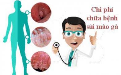 Chi phí điều trị sùi mào gà phụ thuộc vào nhiều yếu tố