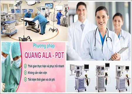 Chữa sùi mào gà âm đạo, phương pháp ALA-PDT Chữa sùi mào gà âm đạo, phương pháp ALA-PDT