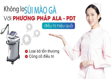 Chữa sùi mào gà âm hộ bằng phương pháp ALA-PDT