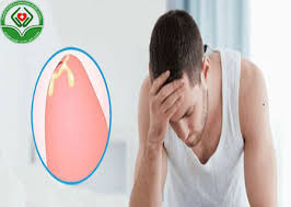 dương vật ra mủ trắng