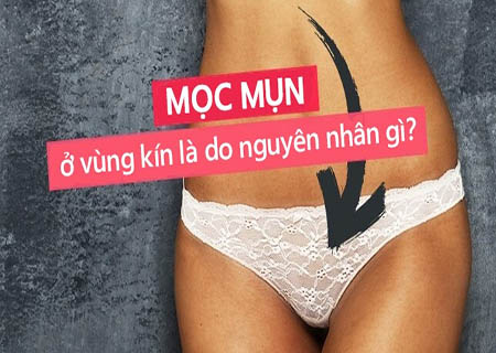 biểu hiện mụn thịt vùng kín nữ