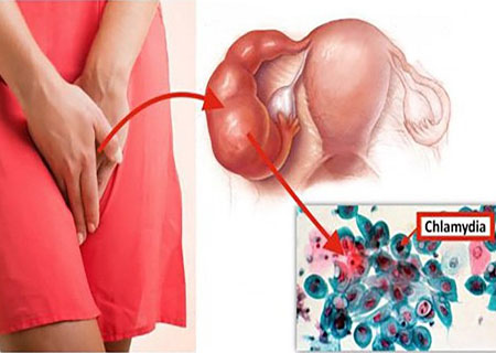 Nấm Chlamydia lây qua nhiều con đường khác nhau