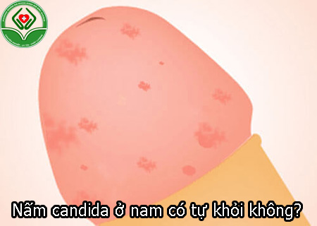 Nấm candida ở nam có tự khỏi không?