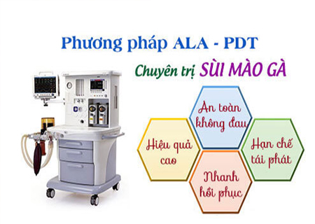 ALA-PDT chữa Mụn vùng kín do sùi mào gà hiệu quả