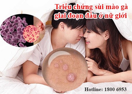 Sùi mào gà giai đoạn đầu ở nữ giới