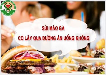 sùi mào gà có lây qua đường ăn uống không