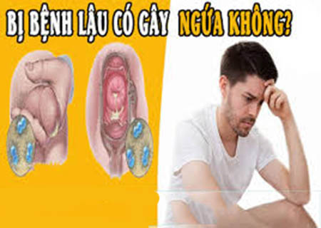 Bệnh lậu có thể gây ngứa cho người bệnh