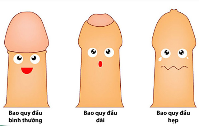 Những điều cần biết về chuỗi hạt ngọc dương vật