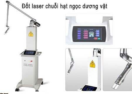 Đốt laser chuỗi hạt ngọc dương vật hiệu quả