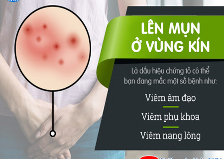 Mọc mụn bọc vùng kín là dấu hiệu của nhiều bệnh nguy hiểm