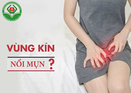 Mọc mụn vùng kín nữ cảnh báo bệnh sùi mào gà